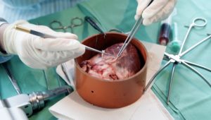 Fortschritte bei Organspende: Pavian überlebt halbes Jahr mit Schweineherz