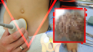 Junge (4 Jahre) hat Bauchschmerzen – Horror-Fund von Ärzten in seinem Bauch